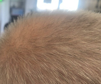 consulenza tricologica